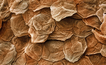 Image: Colored scanning electron micrograph (SEM) of human skin (Photo courtesy of Andrew Syred / SPL).